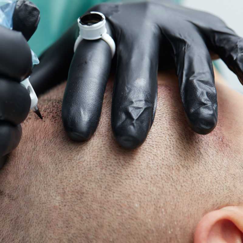 Hairline Tattooing